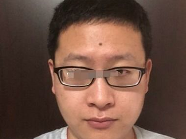 陈晓美人尖：惊艳脸庞的标志性特征