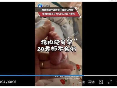 男子带猪肉记号笔陪产怕孩子抱错